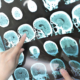 How to File a Mississippi Whistleblower Claim Against a Private Doctor for Medicaid Fraud and Get a Reward.